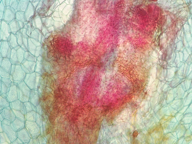 Fern Sporophyte Slides - Fernsporophyte 03 100X